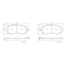 Brembo Front Ceramic Brake Pad P78028N for Subaru Forester, XV, Impreza